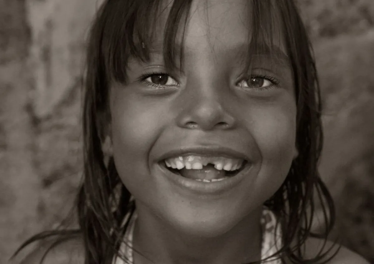 front teeth